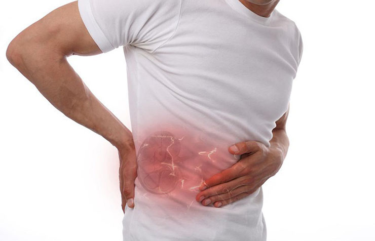 Khi bị sỏi thận sẽ gây ra những cơn đau ở bụng và lưng dưới 